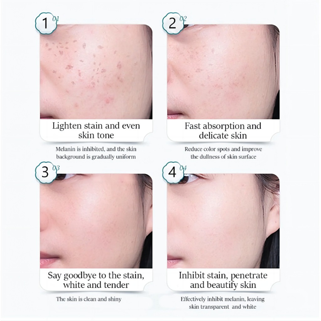 FreeShipping Philippines BUY 2 TAKE 3 Japanese Melasma Cream Yunnan Herbal Whitening Freckle Cream Original Whitening remover cream for face effective anti-aging