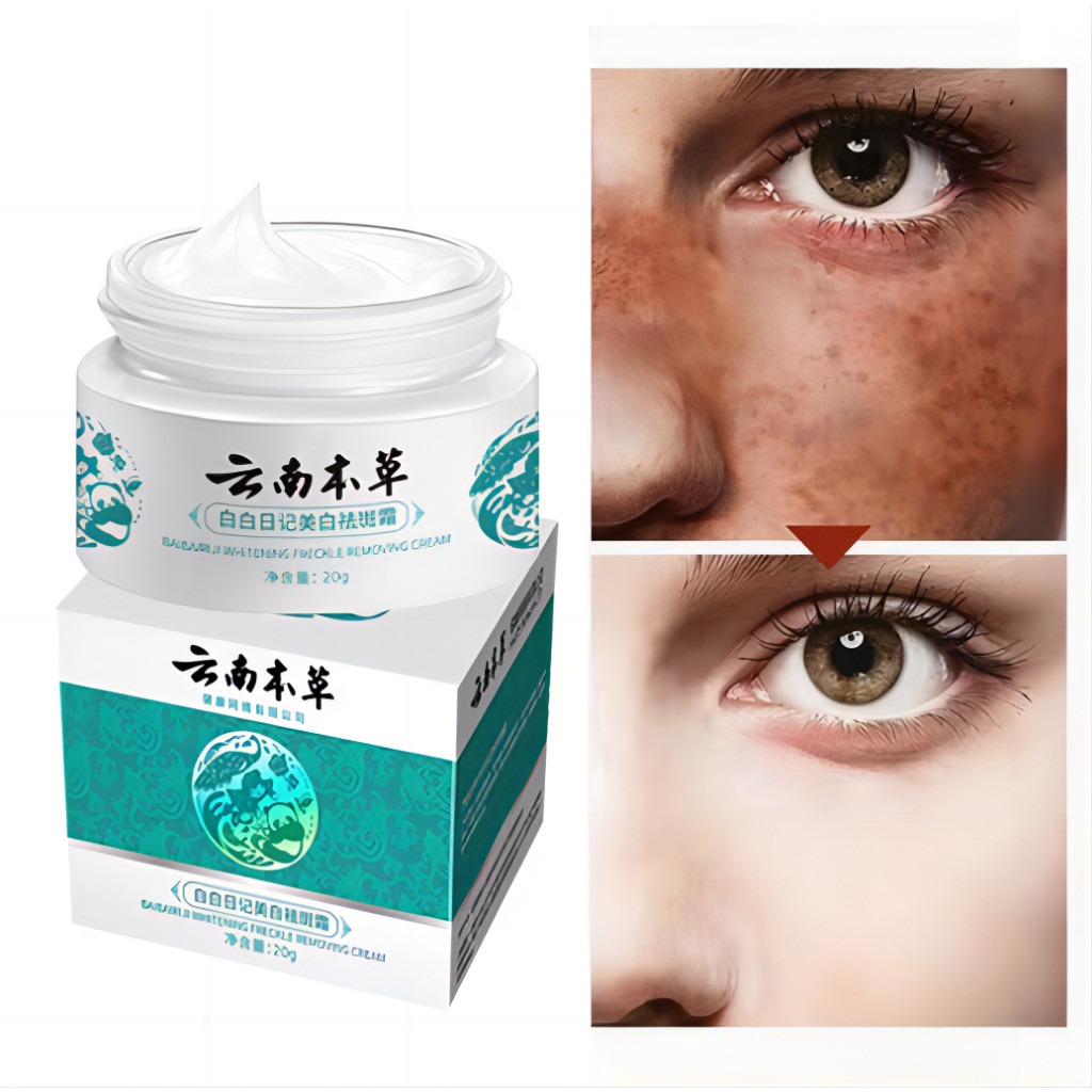 FreeShipping Philippines BUY 2 TAKE 3 Japanese Melasma Cream Yunnan Herbal Whitening Freckle Cream Original Whitening remover cream for face effective anti-aging